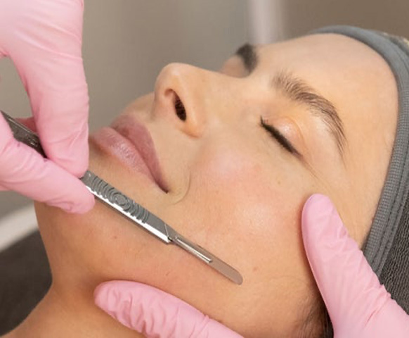 Dermaplanning