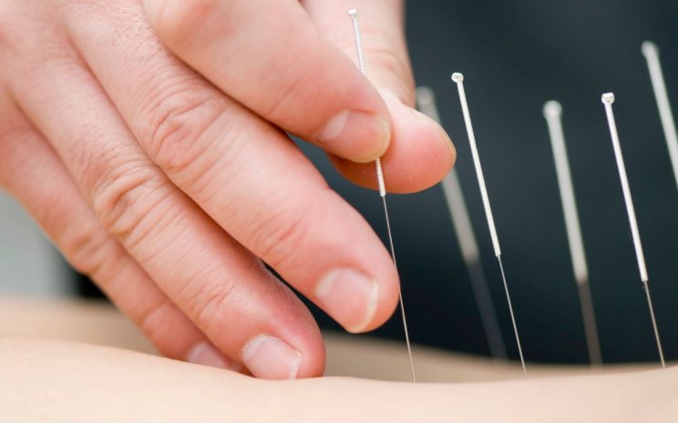 Acupuncture Treatments Brentwood NY