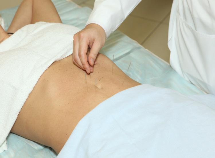 Weight Loss Acupuncture Initial.