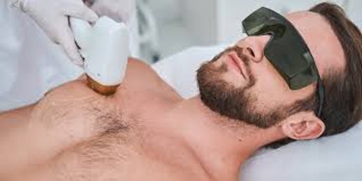 Chest Laser Hair Removal ( ND YAG)