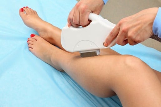 Full Leg Laser Hair Removal