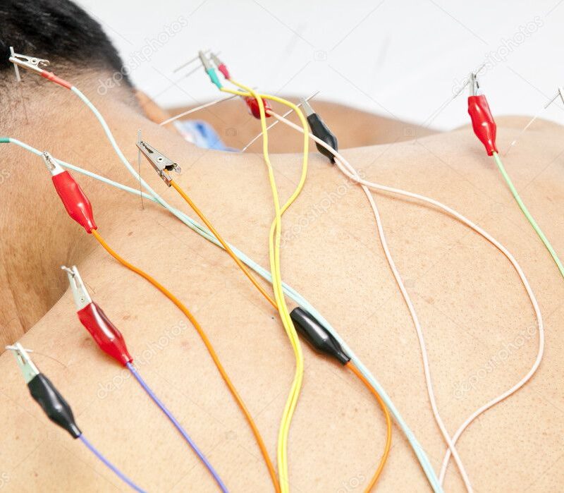 Acupuncture follow-up