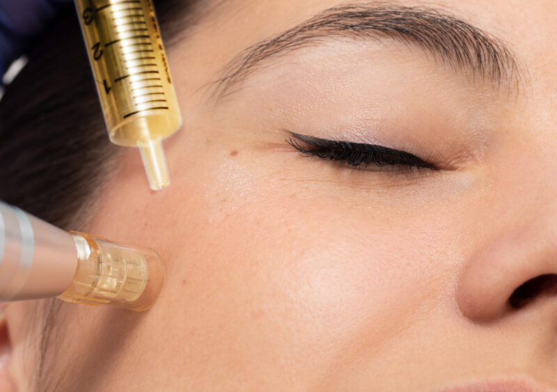 Microneedle