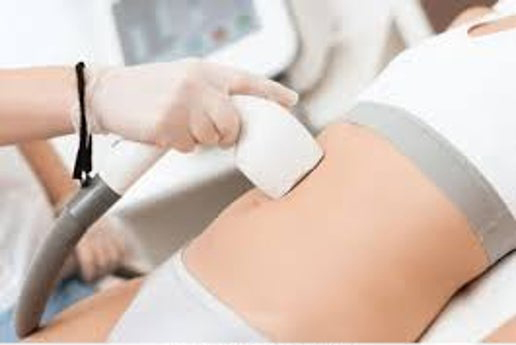 Full Stomach Laser Hair Removal