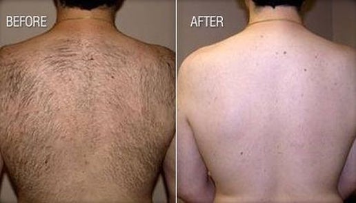 MEN AND WOMAN FULL BACK TREATMENT